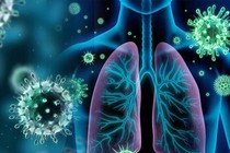 Mách bạn 4 cách phòng ngừa căn bệnh viêm phế quản mạn tính tái phát