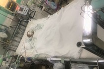 Cứu bé trai 4 tuổi bị đâm xuyên sọ