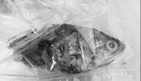 Phần đầu con cá rô dài 13 cm được lấy khỏi cổ họng của bệnh nhân