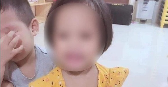 Bé gái bị đinh ghim vào đầu rất khỏe mạnh, hoạt bát khi ở với bà nội