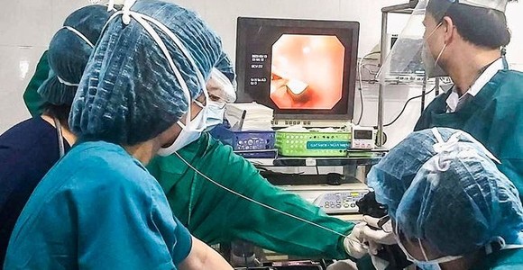 Bệnh viện Đa khoa Gia Đình (TP Đà Nẵng) thực hiện nội soi gắp dị vật là mặt nhẫn ra khỏi dạ dày của bé 16 tháng tuổi.