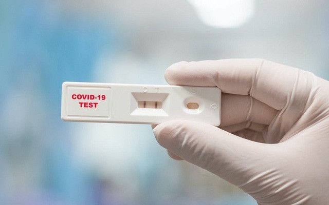 Đề nghị đưa sản phẩm test nhanh COVID-19 vào diện bình ổn giá, Bộ Tài chính lên tiếng - Ảnh 1. Đề nghị đưa sản phẩm test nhanh COVID-19 vào diện bình ổn giá, Bộ Tài chính lên tiếng - Ảnh 1.