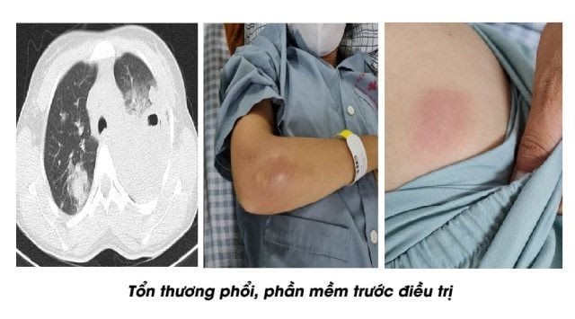 tuyen-quang-whitmore(1).jpg