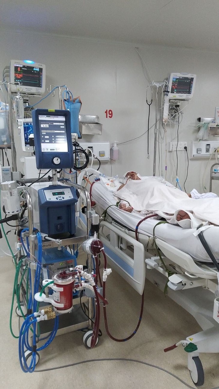 Hơn một tháng, từ ngày 4/10/2021, thai phụ mang song thai 22 tuần tuổi mắc Covid-19 đã hồi phục sau khi được can thiệp ECMO. bn-dang-can-thiep-ecmo.jpg