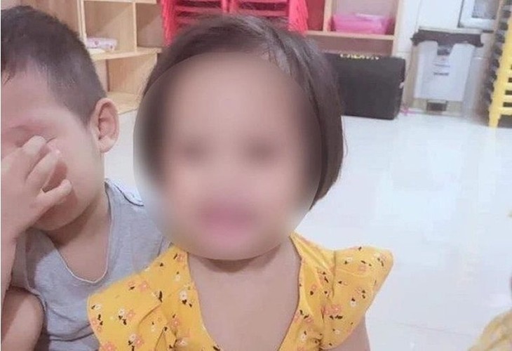 Theo bà nội cháu bé bị đinh ghim vào đầu, cháu bé rất khỏe mạnh, hoạt bát trong thời gian sống cùng ông bà nội. dinh-ghim-vao-dau.jpeg