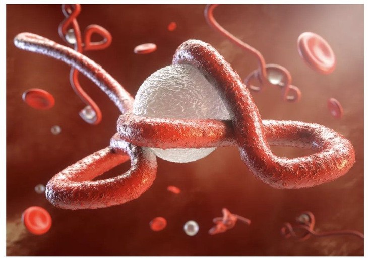 ebola.jpeg