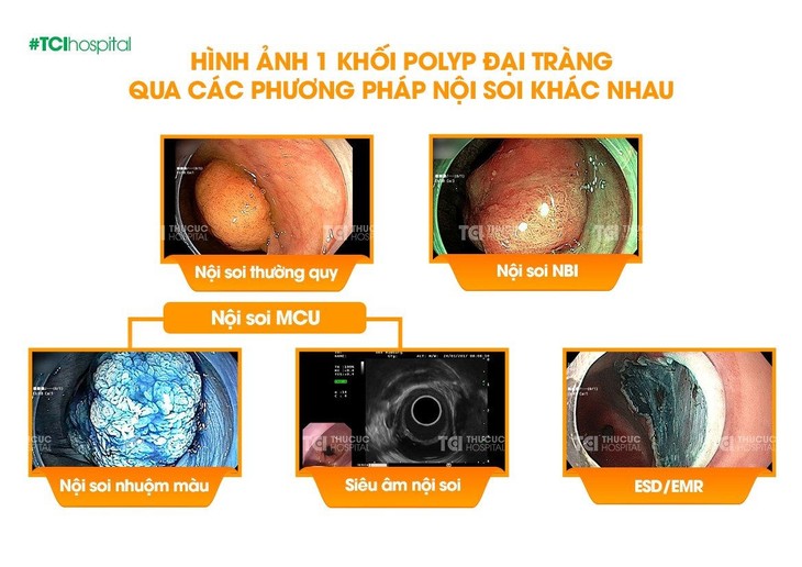 noi-soi-thu-cuc-2.jpg