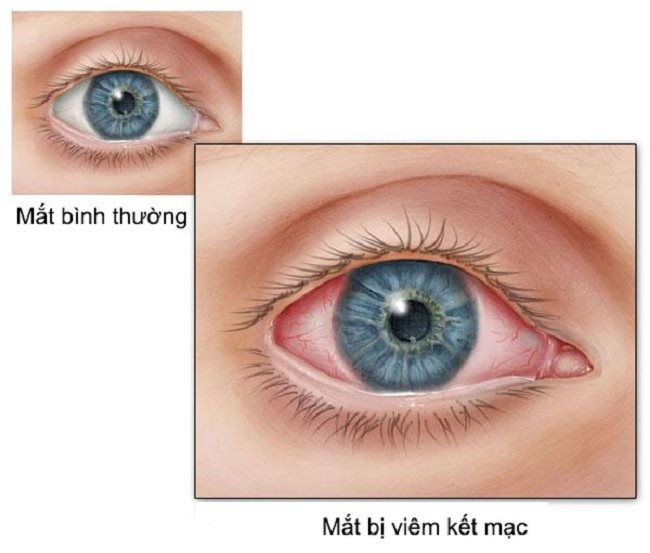 viem-ket-mac.jpg