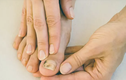 Dấu hiệu “lạ” ở ngón chân cảnh báo tế bào ung thư lộ diện