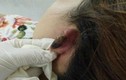 Kinh hoàng: Thiếu nợ tiền, gái trẻ bị hành hung...cắt lỗ tai