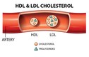 Căn cứ đo lượng cholesterol trong máu