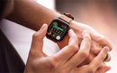 Apple còn gì để nâng cấp trên apple watch series 5?