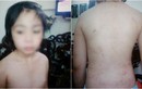 Hà Nội: Nghi vấn bé 10 tuổi bị bố, mẹ kế bạo hành dã man