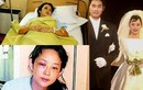Loạt minh tinh Hàn Quốc từng bị chồng đánh đến mức phải nhập viện
