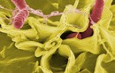 5 câu hỏi lớn về vi khuẩn Salmonella nguy hiểm