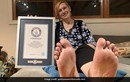 Kỳ lạ người phụ nữ có bàn chân to nhất thế giới