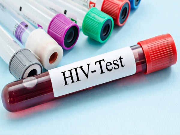 Virus giống HIV, lây sang người nguy hiểm không?